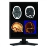 MS Standard - NEC MultiSync MD212MC 21.3-inch Medical Diagnostic LCD Monitor